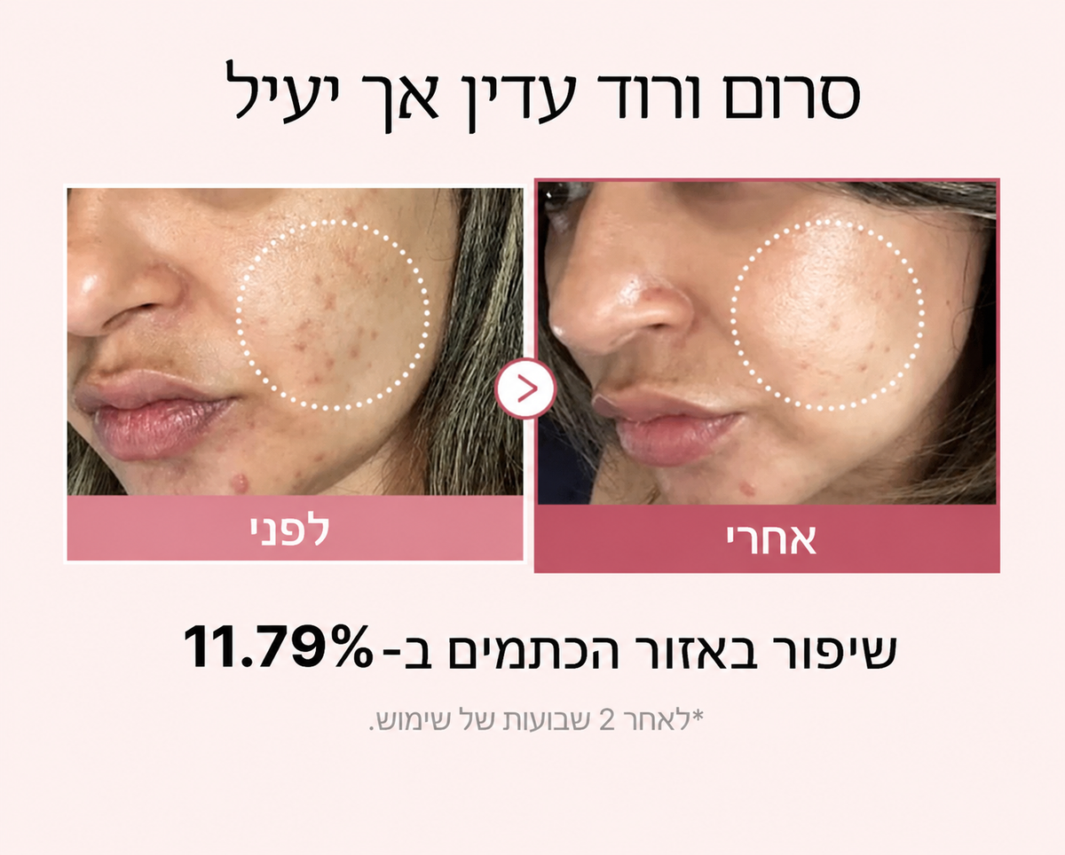 Medicube PDRN Pink Peptide Serum | סרום פפטידים ורוד למראה עור מוצק וזוהר בגימור ״עור זכוכית״