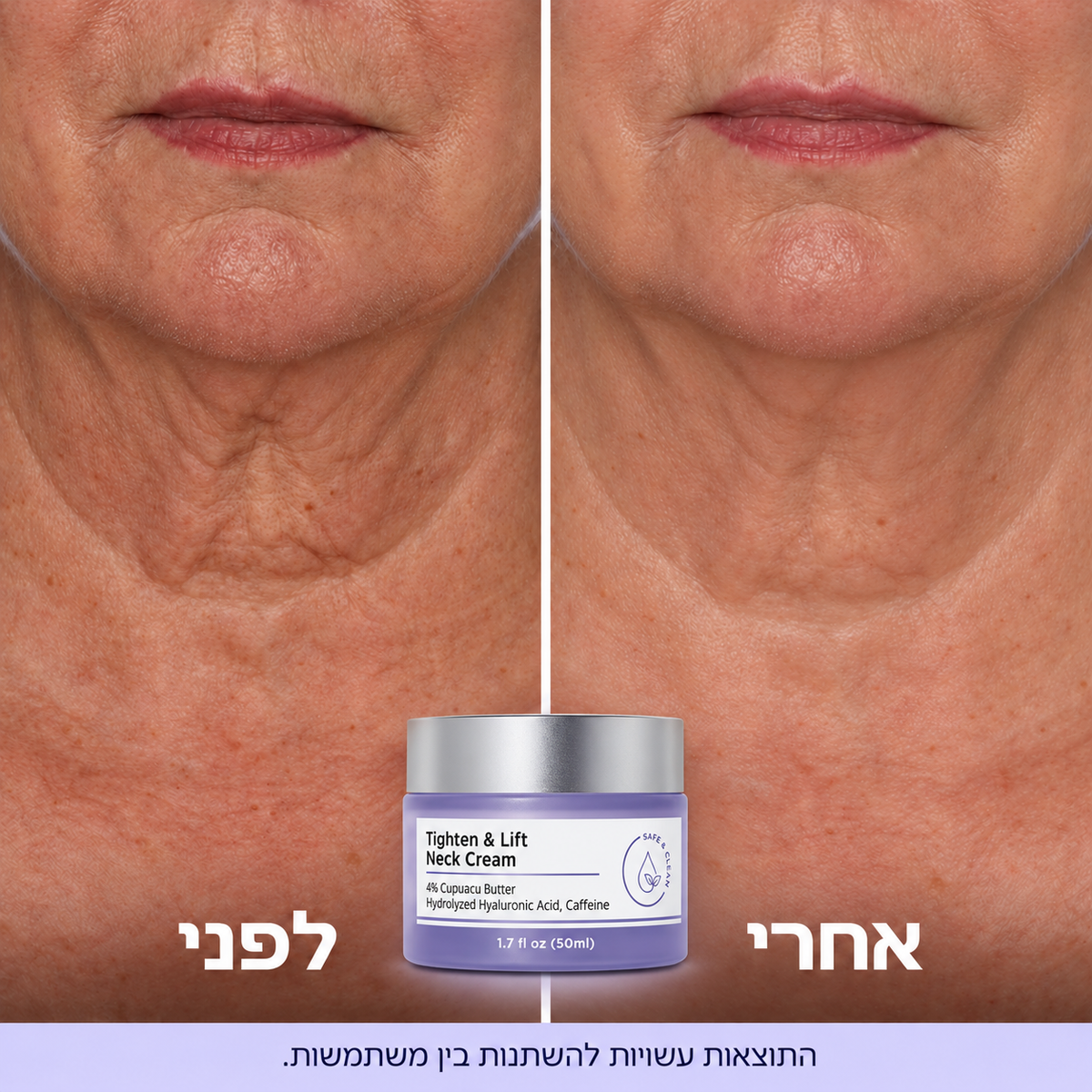 קרם למיצוק והרמת אזור הצוואר