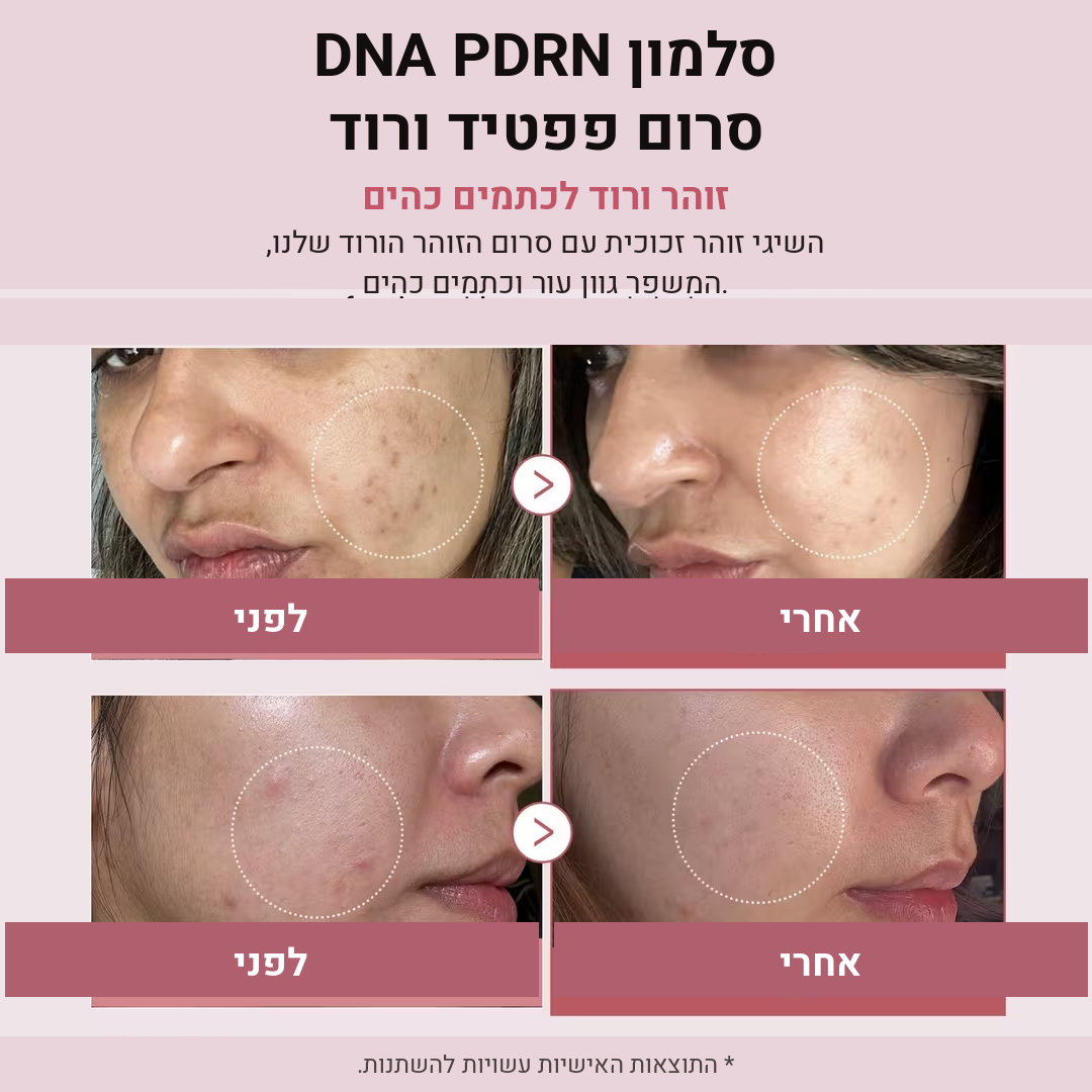Medicube PDRN Pink Peptide Serum – סרום ה-PDRN הוורוד למתיחה וזוהר מיידי mutualdropshopping
