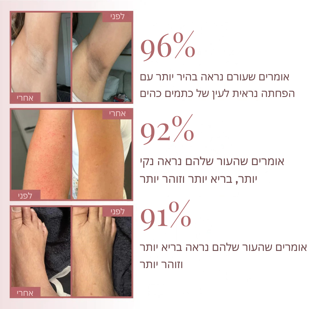 תרסיס פילינג לגוף – חומצה קוג'ית + כורכום + ניאצינאמיד mutualdropshopping