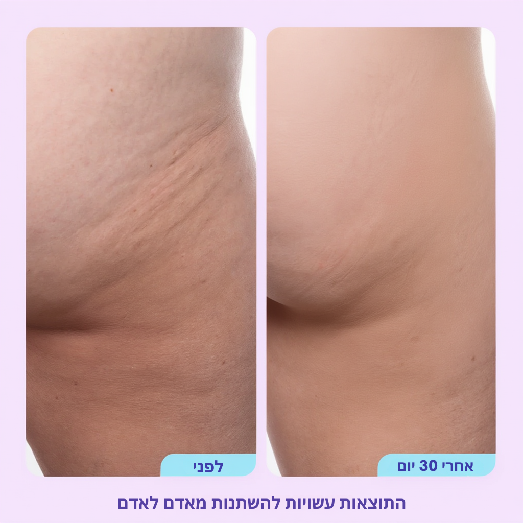 קרם לשיפור מיצוק ולחות האזור העכוז mutualdropshopping