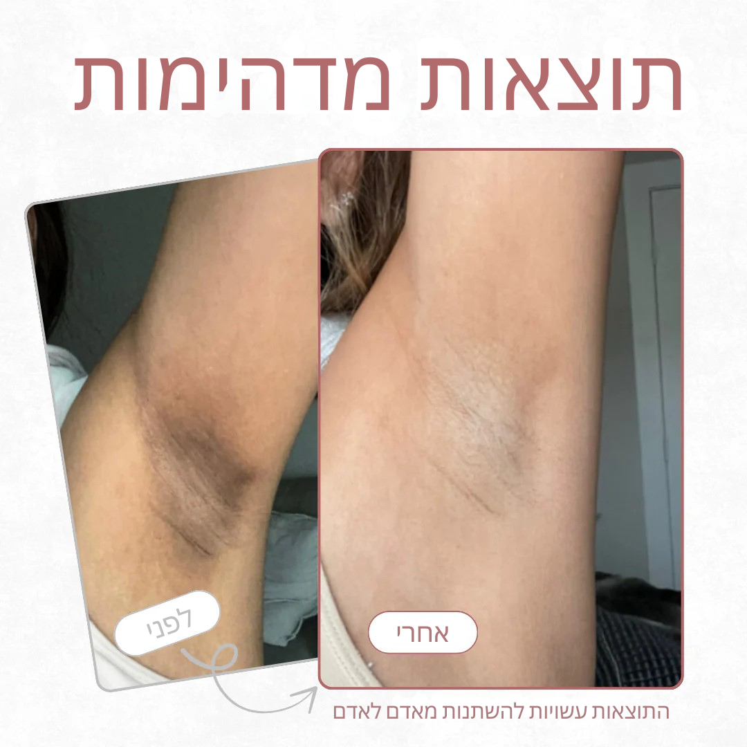 תרסיס פילינג לגוף – חומצה קוג'ית + כורכום + ניאצינאמיד mutualdropshopping