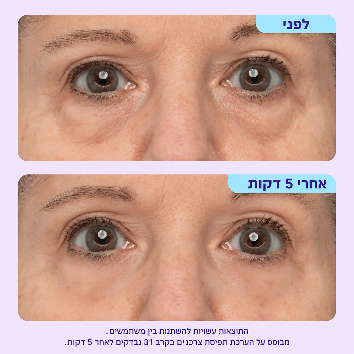 ג׳ל להרמה מיידית של אזור העיניים