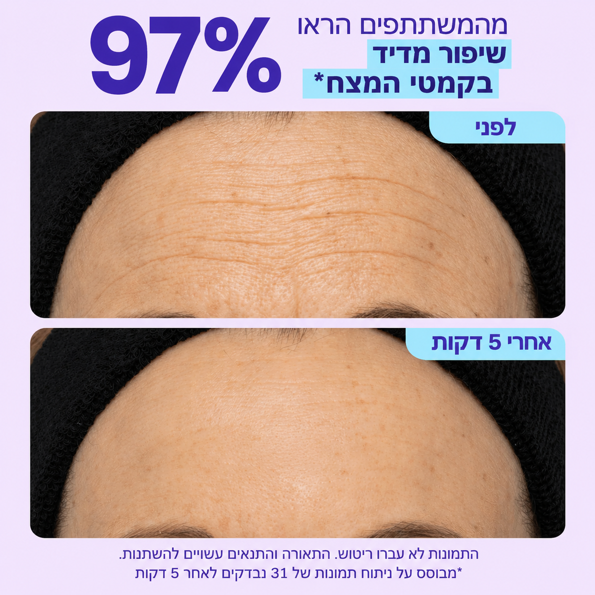ג׳ל להרמה מיידית של אזור העיניים