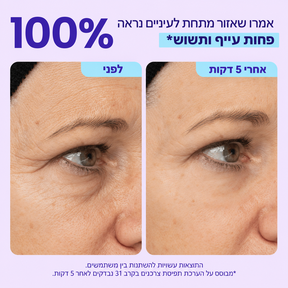 ג׳ל להרמה מיידית של אזור העיניים