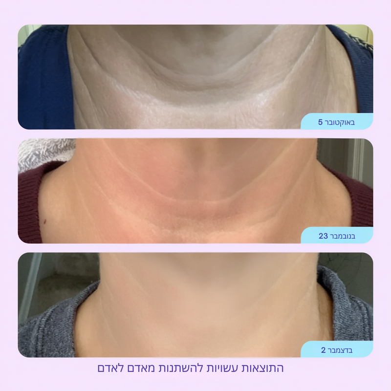 Veloura Neck Lift – קרם הרמה ומיצוק לצוואר
