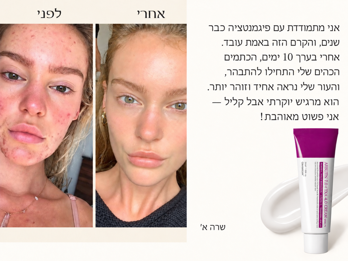 קרם קוריאני מתקדם להבהרת העור עם ארבוטין
